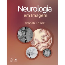 NEUROLOGIA EM IMAGEM