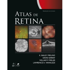 ATLAS DE RETINA