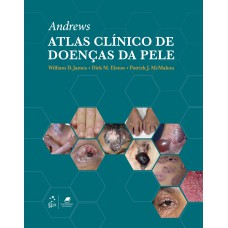 ANDREWS ATLAS CLÍNICO DE DOENÇAS DA PELE