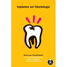 IMPLANTES EM ODONTOLOGIA