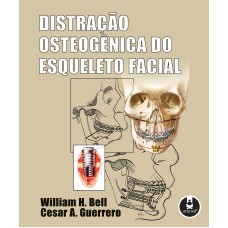 DISTRAÇÃO OSTEOGÊNICA DO ESQUELETO FACIAL