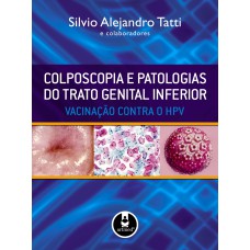 COLPOSCOPIA E PATOLOGIAS DO TRATO GENITAL INFERIOR: VACINAÇÃO CONTRA O HPV