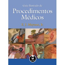 GUIA ILUSTRADO DE PROCEDIMENTOS MÉDICOS