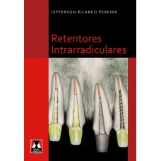 RETENTORES INTRARRADICULARES