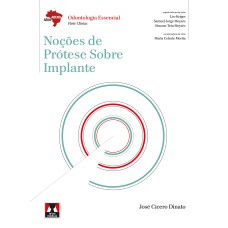 NOÇÕES DE PRÓTESE SOBRE IMPLANTE