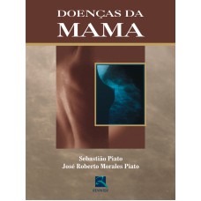 DOENÇAS DA MAMA