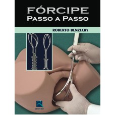 FÓRCIPE PASSO A PASSO