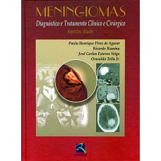 MENINGIOMAS - DIAGNÓSTICO E TRATAMENTO CLÍNICO E CIRÚRGICO - ASPECTOS ATUAIS