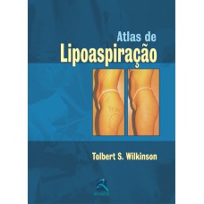 ATLAS DE LIPOASPIRAÇÃO