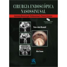 CIRURGIA ENDOSCOPICA NASOSSINUSAL: ANATOMIA, RECONSTRUÇÃO TRIDIMENSIONAL E TÉCNICA CIRÚRGICA