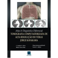 ATLAS & DIAGNÓSTICO DIFERENCIAL - TOMOGRAFIA COMPUTADORIZADA DE ALTA RESOLUÇÃO DO TÓRAX JORGE KAVAKAMA