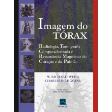 IMAGEM DO TÓRAX: RADIOLOGIA, TOMOGRAFIA COMPUTADORIZADA, E RESSONÂNCIA MAGNÉTICA DO CORAÇÃO E DO PULMÃO