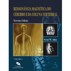 RESSONÂNCIA MAGNÉTICA DO CÉREBRO E DA COLUNA VERTEBRAL