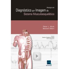 AVANÇOS EM DIAGNÓSTICOS POR IMAGEM DO SISTEMA MUSCULOESQUELÉTICO