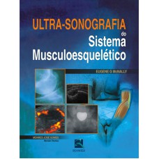 ULTRASSONOGRAFIA DO SISTEMA MUSCULOESQUELÉTICO