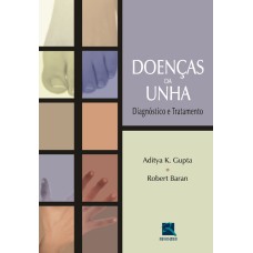 DOENÇAS DA UNHA - DIAGNÓSTICO E TRATAMENTO