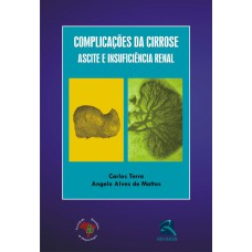 COMPLICAÇÕES DA CIRROSE - ASCITE E INSUFICIÊNCIA RENAL