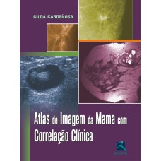 ATLAS DE IMAGEM DA MAMA COM CORRELAÇÃO CLÍNICA