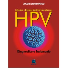 INFECÇÕES E DOENÇAS GENITAIS CAUSADAS POR HPV: DIAGNÓSTICO E TRATAMENTO