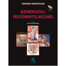 BLEFAROPLASTIA E PROCEDIMENTOS ANCILARES