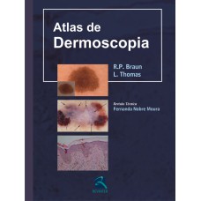 ATLAS DE DERMOSCOPIA