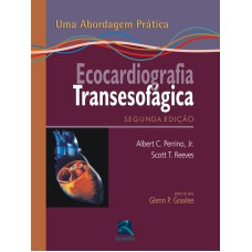 ECOCARDIOGRAFIA TRANSESOFÁGICA