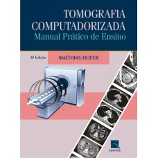 TOMOGRAFIA COMPUTADORIZADA - MANUAL PRÁTICO DE ENSINO