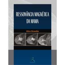 RESSONÂNCIA MAGNÉTICA DA MAMA