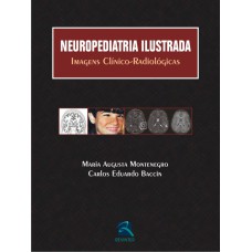 NEUROPEDIATRIA ILUSTRADA - IMAGENS CLÍNICO-RADIOLÓGICAS