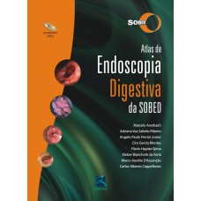 ATLAS DE ENDOSCOPIA DIGESTIVA DA SOBED