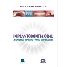 IMPLANTODONTIA ORAL: ALTERNATIVA PARA UMA PRÓTESE BEM-SUCEDIDA