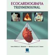 ECOCARDIOGRAFIA TRIDIMENSIONAL