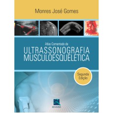 ATLAS COMENTADO DE ULTRASONOGRAFIA MUSCULOESQUELÉTICA