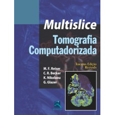 TOMOGRAFIA COMPUTADORIZADA MULTISLICE