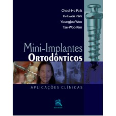 MINI-IMPLANTES ORTODÔNTICOS: APLICAÇÕES CLÍNICAS