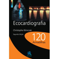 ECOCARDIOGRAFIA: 120 ARMADILHAS