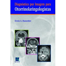 DIAGNÓSTICO POR IMAGEM PARA OTORRINOLARINGOLOGISTAS