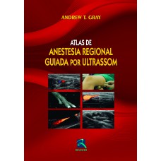 ATLAS DE ANESTESIA REGIONAL GUIADA POR ULTRASSOM