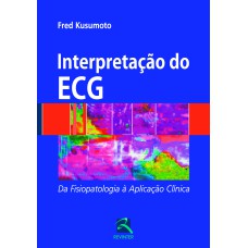 INTERPRETAÇÃO DO ECG