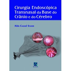 CIRURGIA ENDOSCÓPICA TRANSNASAL DA BASE DO CRÂNIO