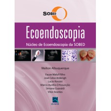 ECOENDOSCOPIA