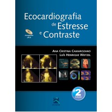 ECOCARDIOGRAFIA DE ESTRESSE E CONTRASTE