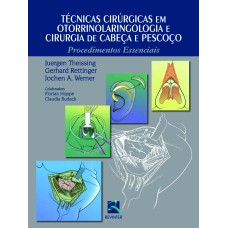 TÉCNICAS CIRÚRGICAS EM OTORRINOLARINGOLOGIA