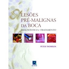 LESÕES PRÉ - MALÍGNAS DA BOCA