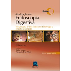 SOBED ATUALIZAÇÃO EM ENDOSCOPIA DIGESTIVA - VOLUME 1: TERAPÊUTICA ENDOSCÓPICA NO ESTÔMAGO E INTESTINO DELGADO - ANO 2