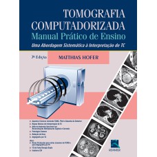 TOMOGRAFIA COMPUTADORIZADA: MANUAL PRÁTICO DE ENSINO - UMA ABORDAGEM SISTEMÁTICA À INTERPRETAÇÃO DE TC