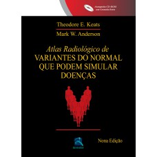 ATLAS RADIOLÓGICO DE VARIANTES DO NORMAL QUE PODEM SIMULAR DOENÇAS