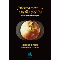 COLESTEATOMA DA ORELHA MÉDIA: TRATATAMENTO CIRÚRGICO