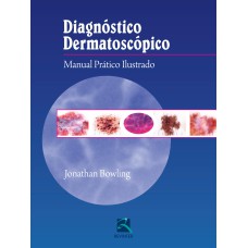 DIAGNÓSTICO DERMATOSCÓPICO