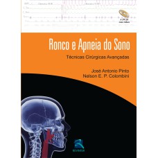 RONCO E APNEIA DO SONO: TÉCNICAS CIRÚRGICAS AVANÇADAS